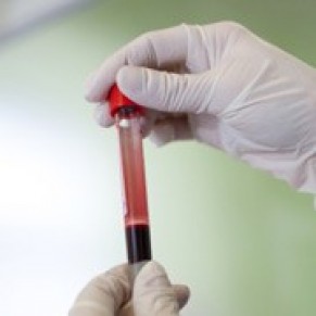 Les diagnostics en France se font  un stade plus prcoce, indique une tude - VIH / Sida