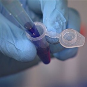 Des anticorps protgent des singes du VIH pendant des mois - Recherche