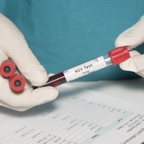 Vers une dtection du VIH une semaine aprs contamination - Espagne