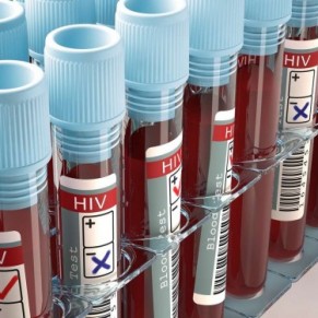 Le CNRS appelle un laboratoire <I> ne pas veiller d'espoirs infonds</I> -  Projet de vaccin anti-VIH