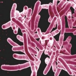 Un test de dtection rapide de la tuberculose mis au point - USA