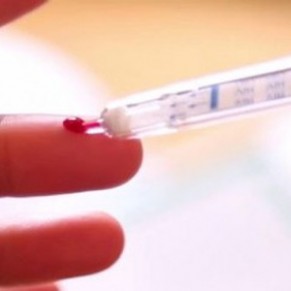 Une premire au Brsil, les tests du sida en vente dans les pharmacies - VIH