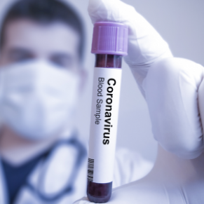 Des antiviraux contre le VIH tests dans un mix contre le coronavirus  - Traitement 