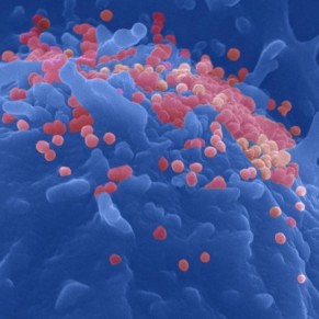 Comment de rares individus russissent  matriser le VIH sans traitement - Sant 