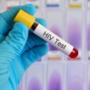 Forte diminution du dpistage du VIH en France lors du 1er confinement - Covid-19